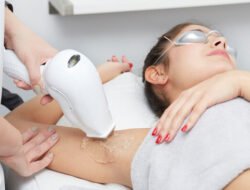 Laser Hair Removal, Treatment yang Terakhir menjadi favorit