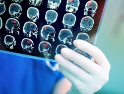 Mengenal Tumor Jinak dan Ganas: Begini Cara Membedakannya Secara Medis