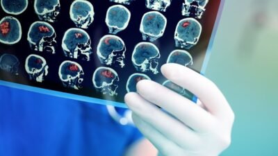 Mengenal Tumor Jinak dan Ganas: Begini Cara Membedakannya Secara Medis