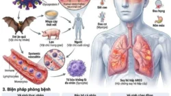 virus nipah pada otak