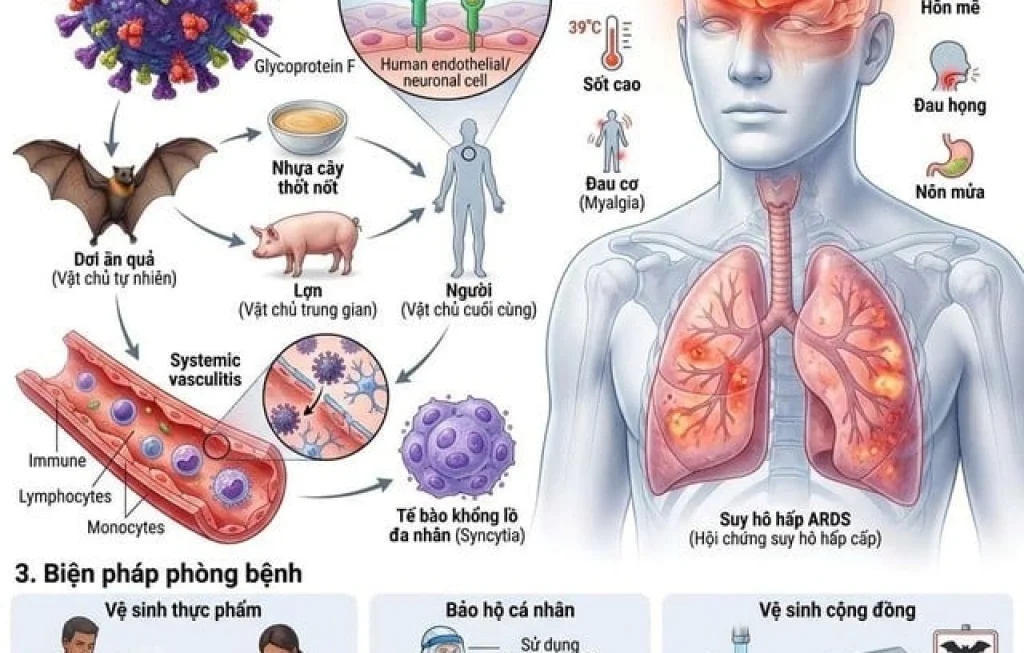 virus nipah pada otak
